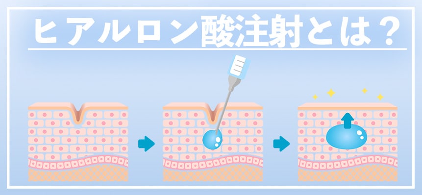 まず知っておきたいポイント