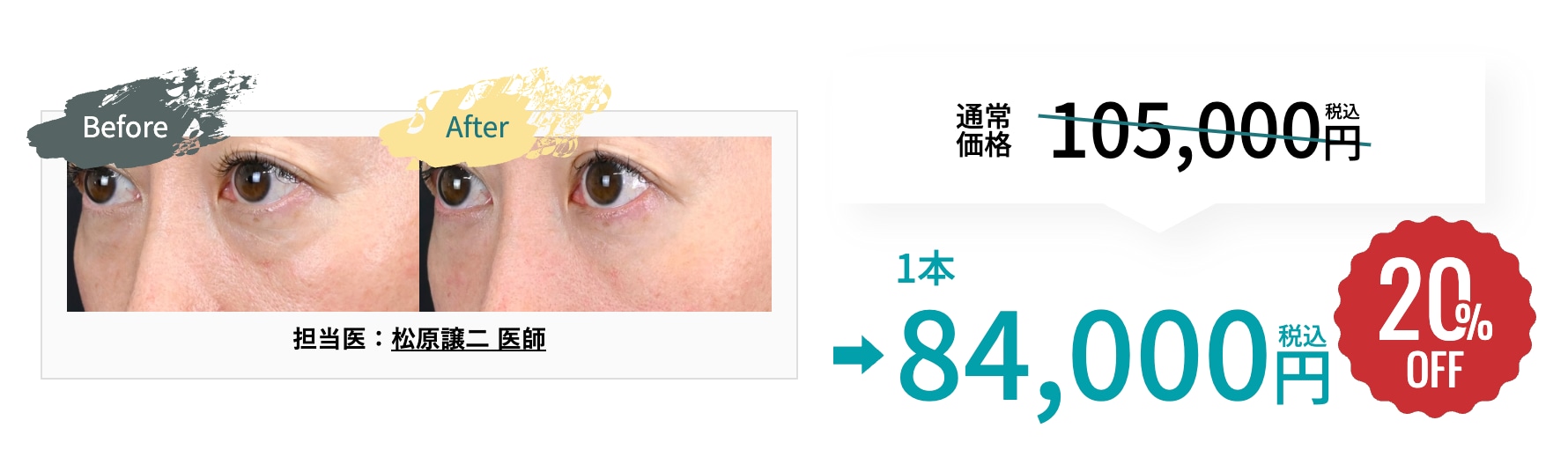 お得に、クマ治療したい方は今がチャンスです！