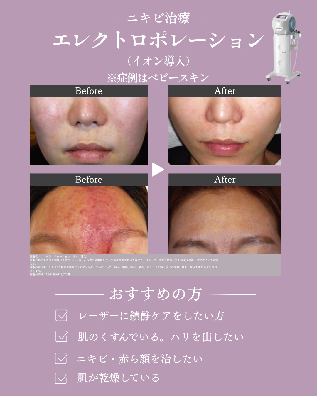 レーザーとの併用でさらなる改善へ