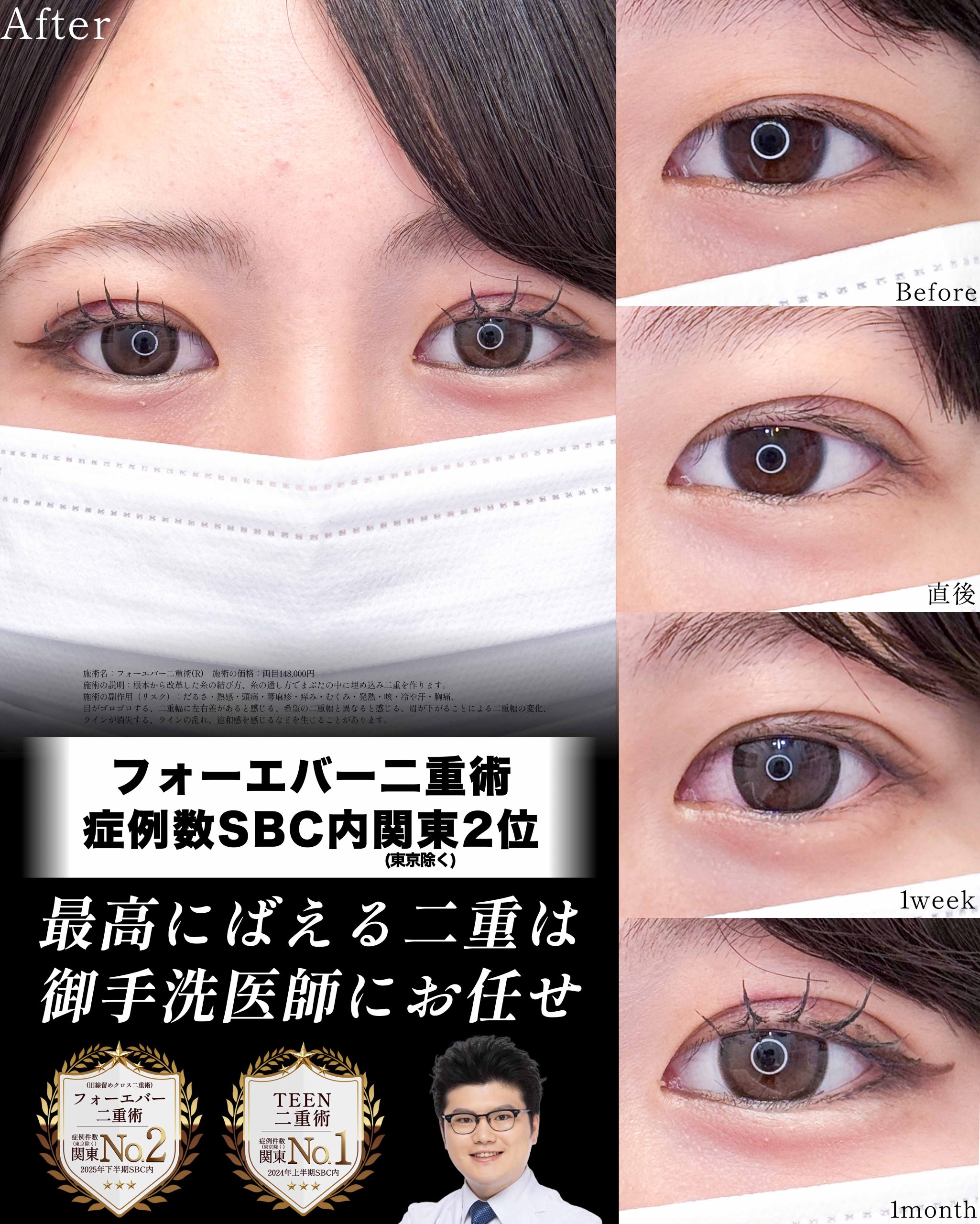 最高に「映える」二重、お任せください！