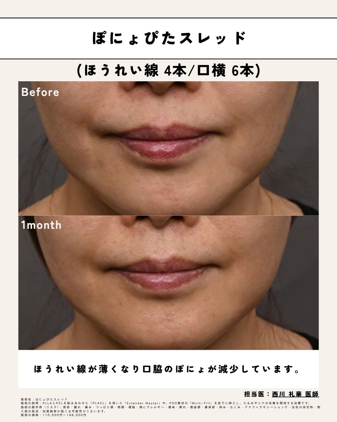 外科治療ではありません。簡単に施術できるのにこの変化。