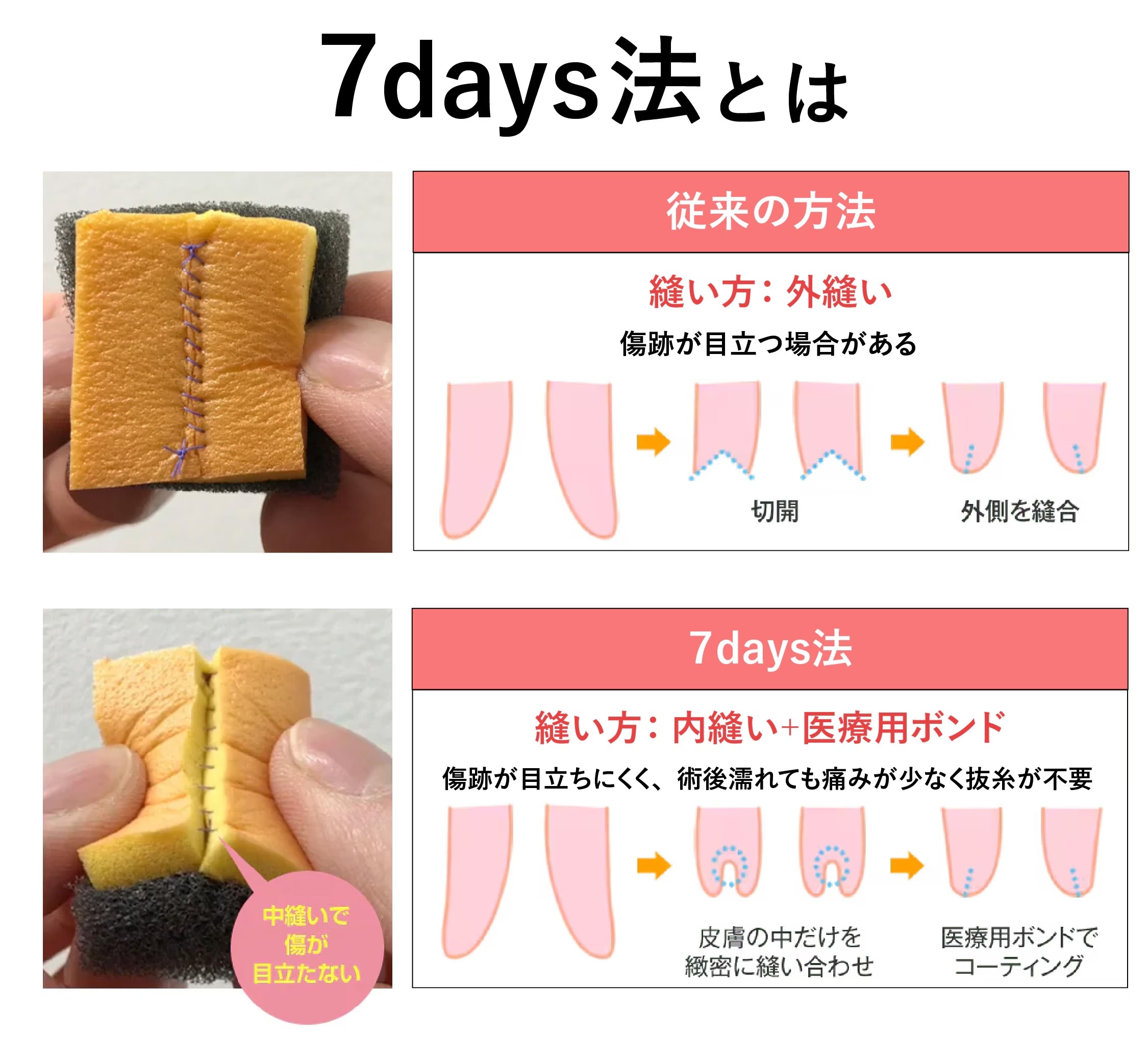 【SBCオリジナル】7days法