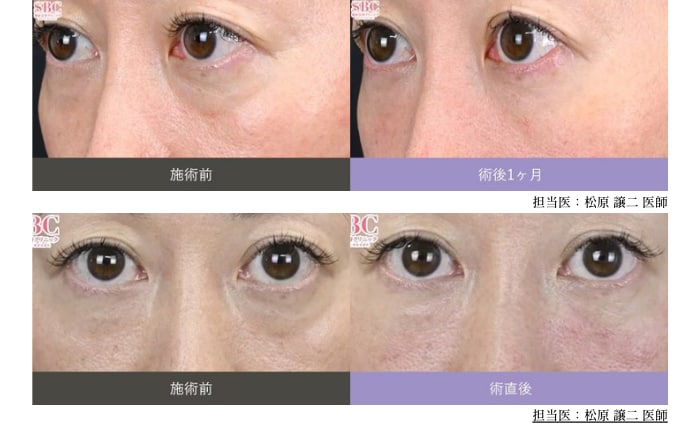 ベビーコラーゲンの症例写真