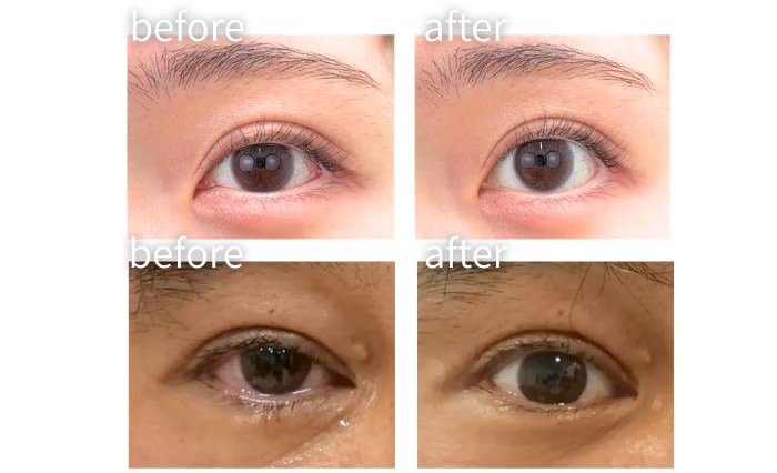 点眼10分後…！