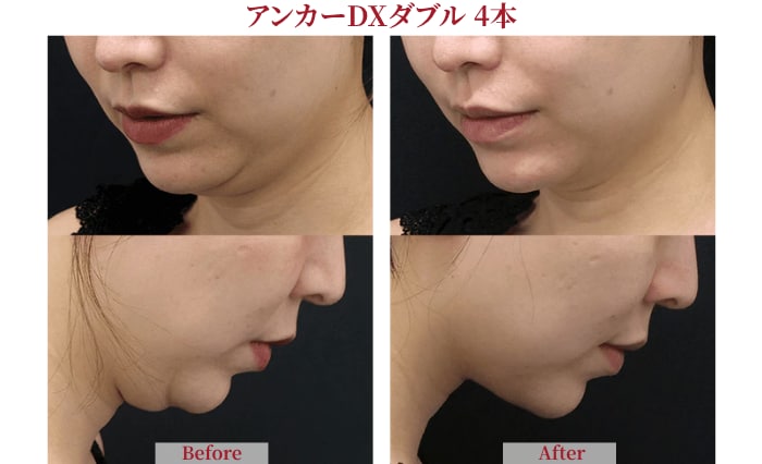 ▼症例写真をご覧ください▼