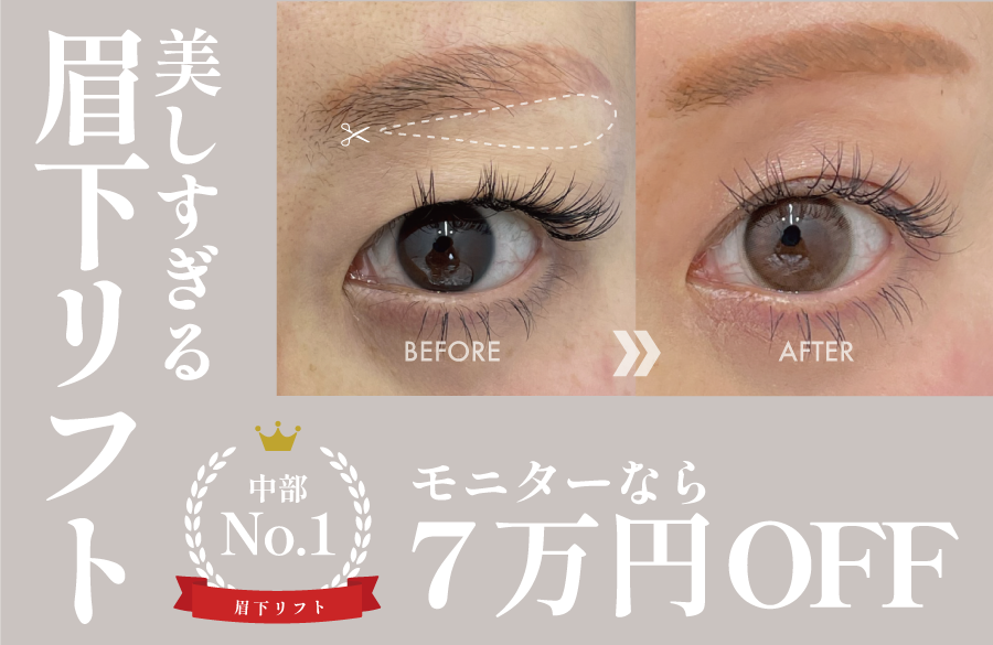美しすぎる眉下リフト