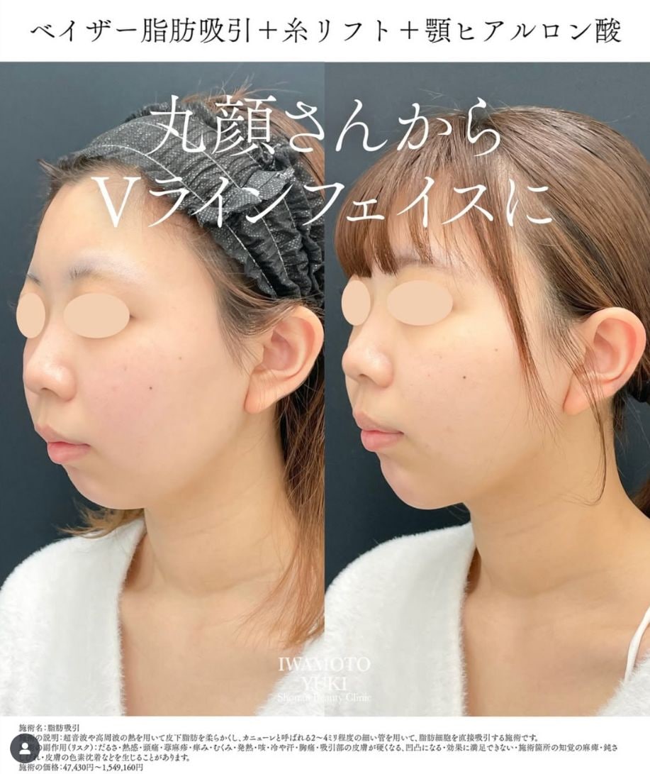 ベスト１