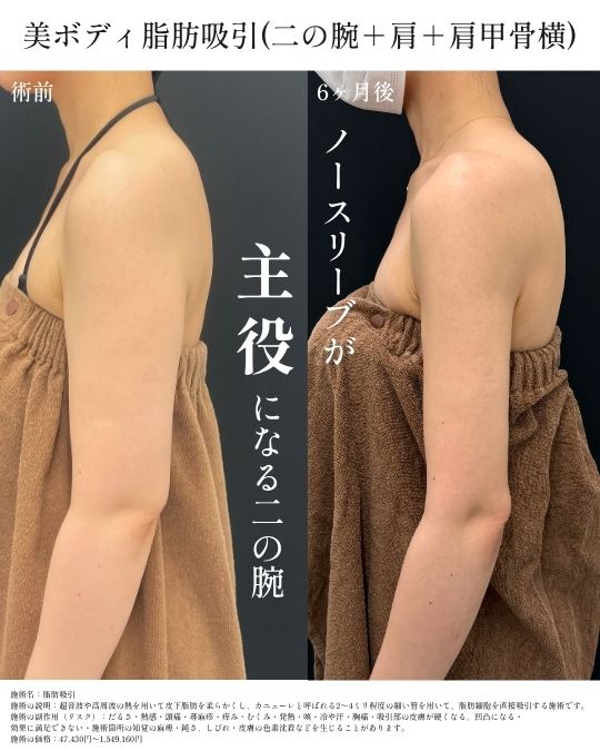 ベスト２