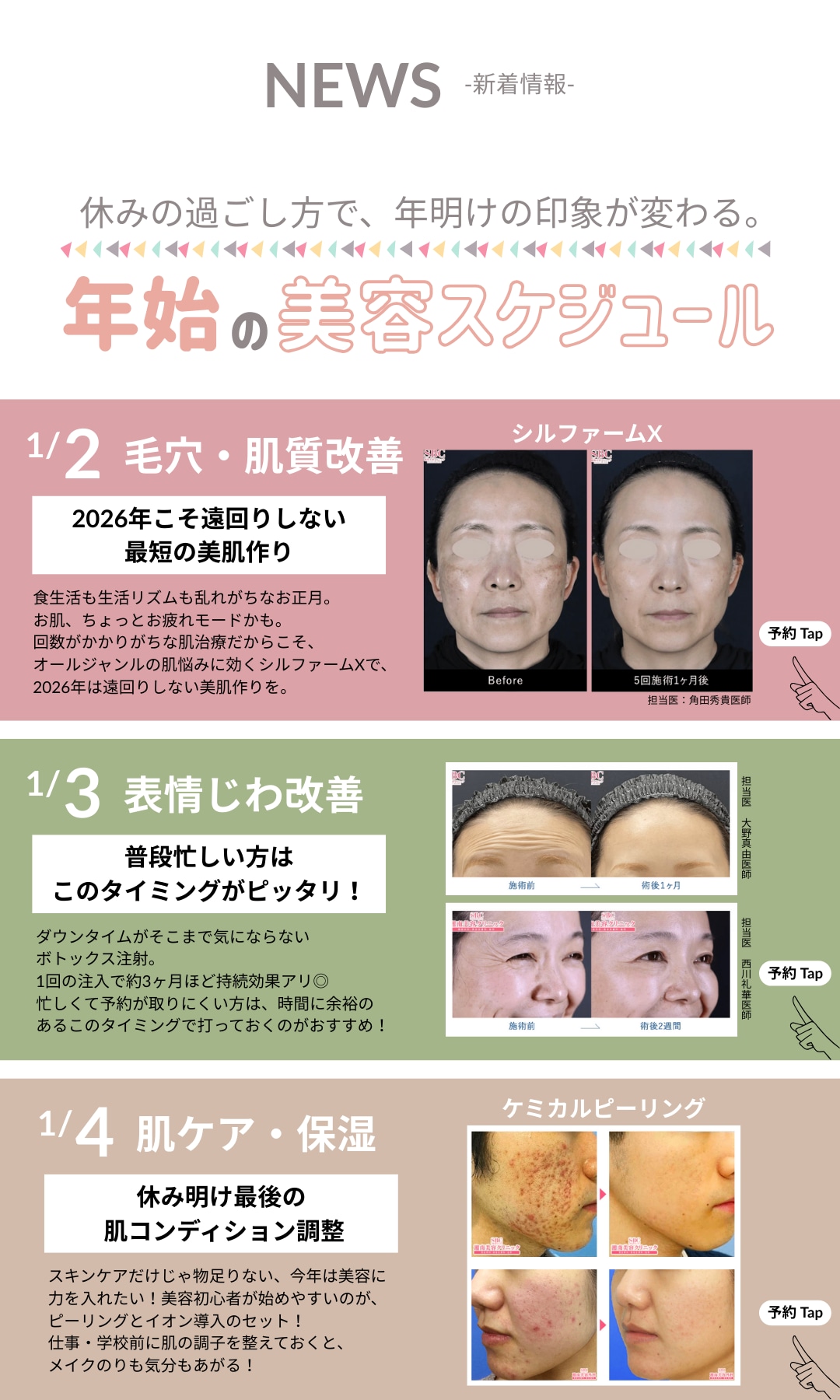 年始の美容の予約をする