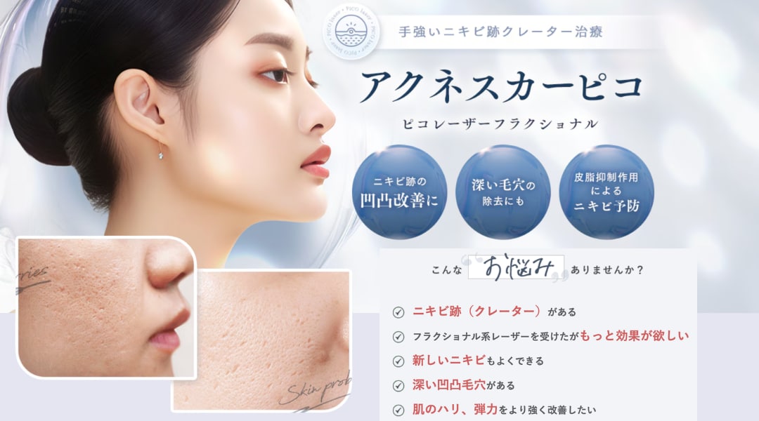 消えないニキビ跡やクレーター毛穴に強力に効く『アクネスカーピコ』