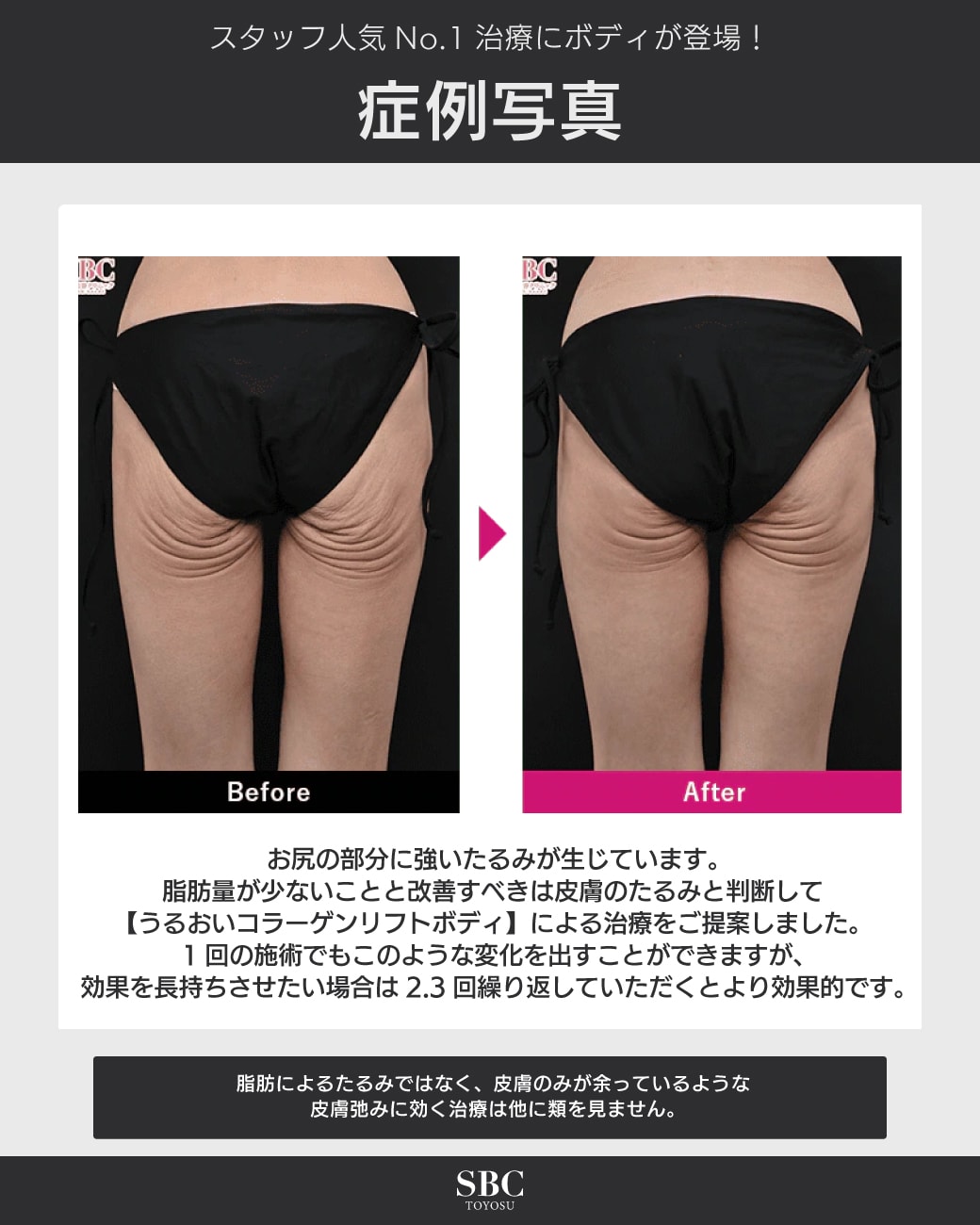 症例写真