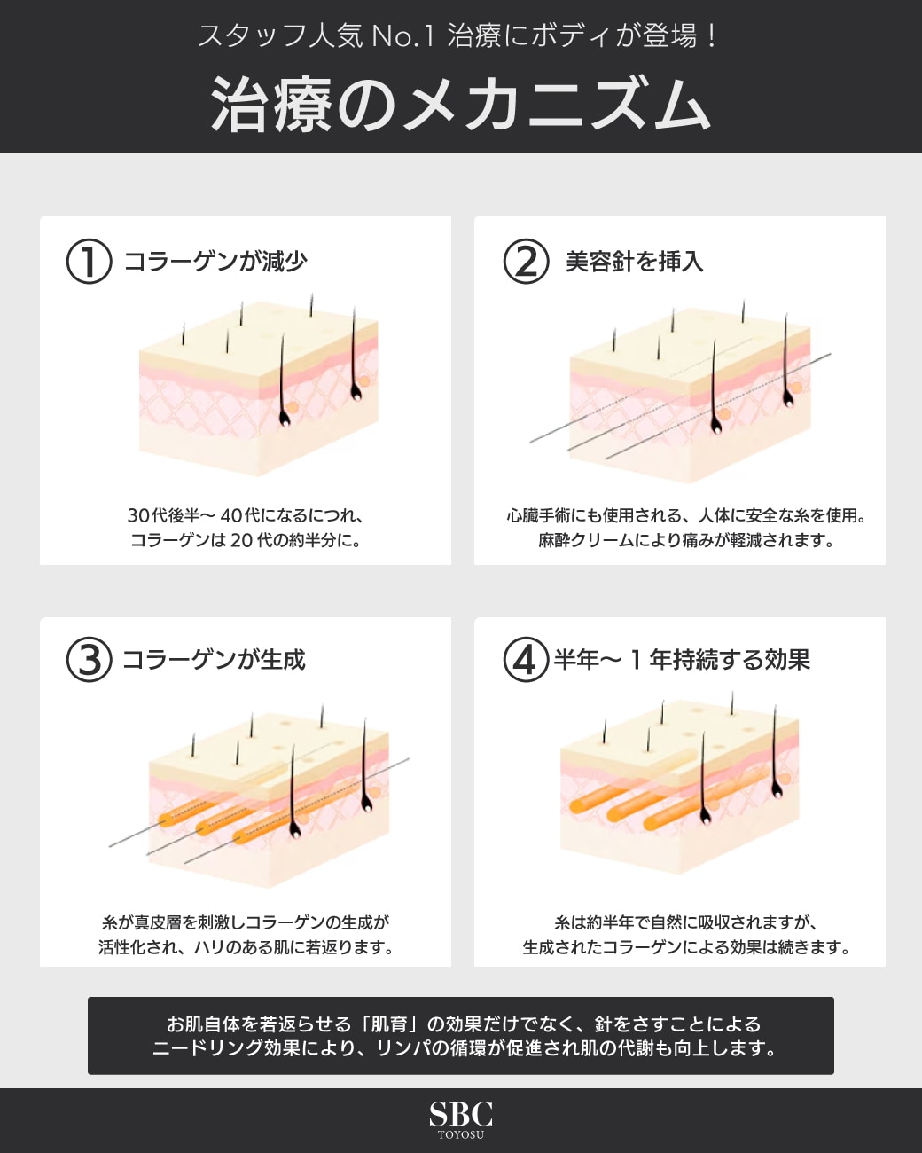 治療のメカニズム