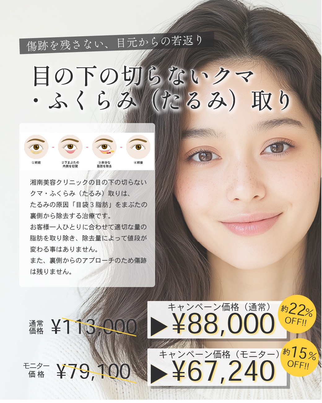 傷跡を残さない、目元からの若返り