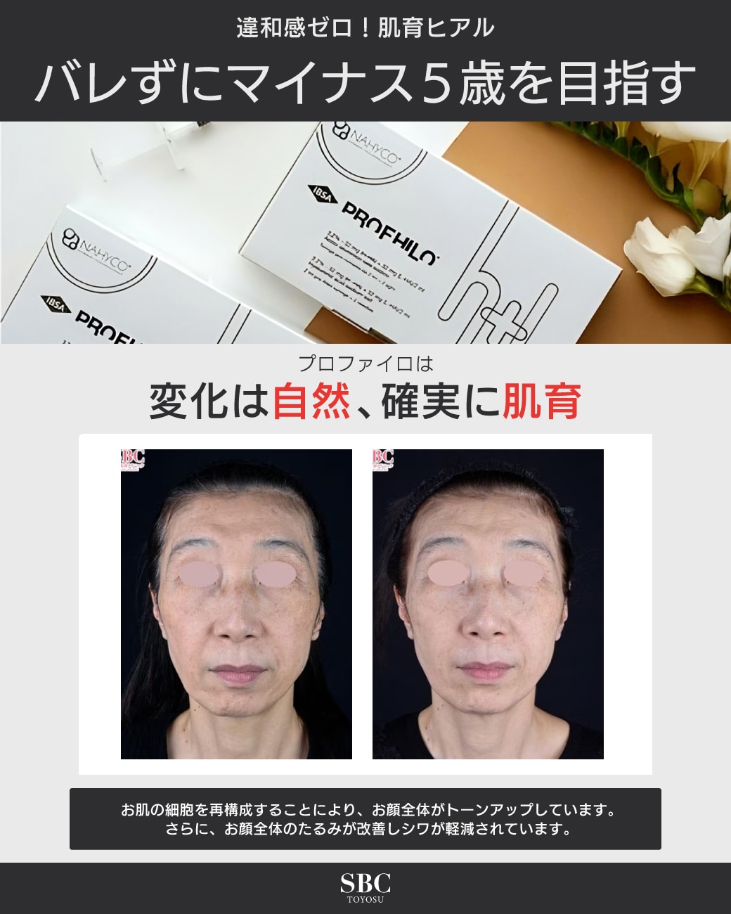 バレずにマイナス5歳を目指す