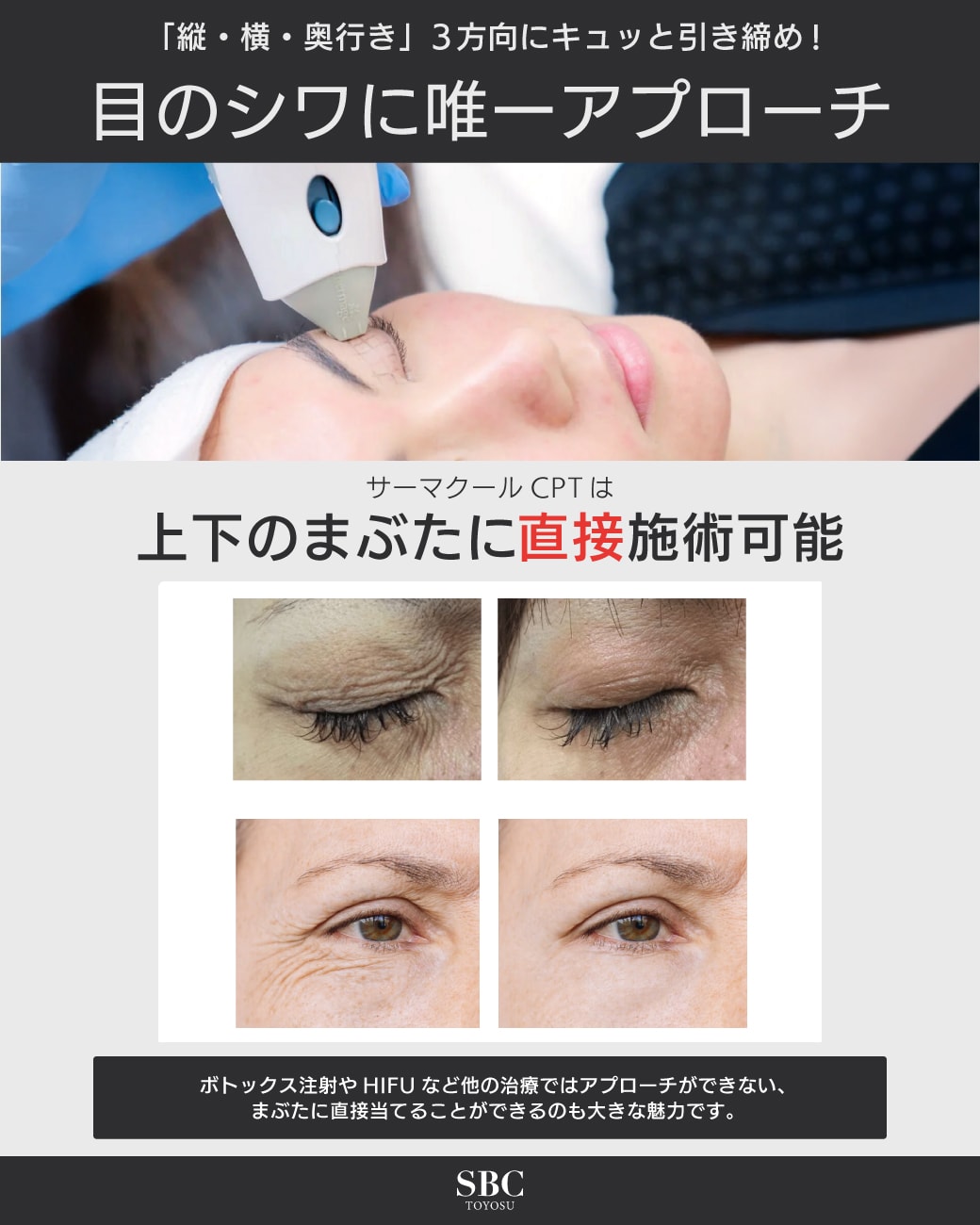 目のシワに唯一アプローチ