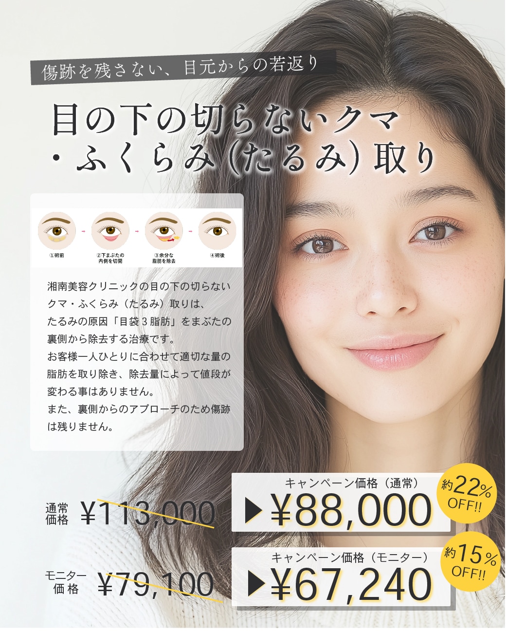 傷跡を残さない、目元からの若返り