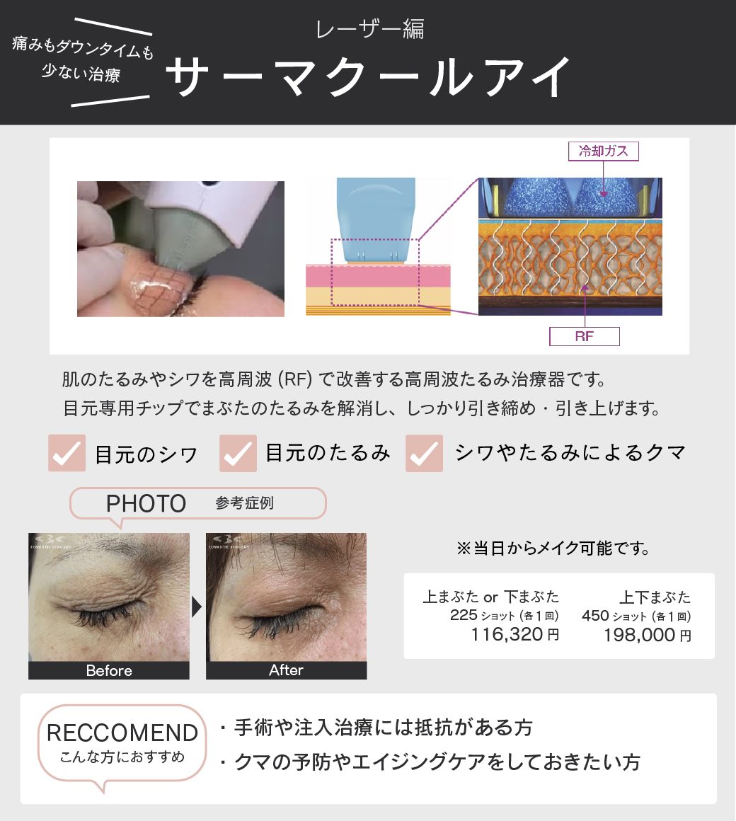 サーマクールアイとは?