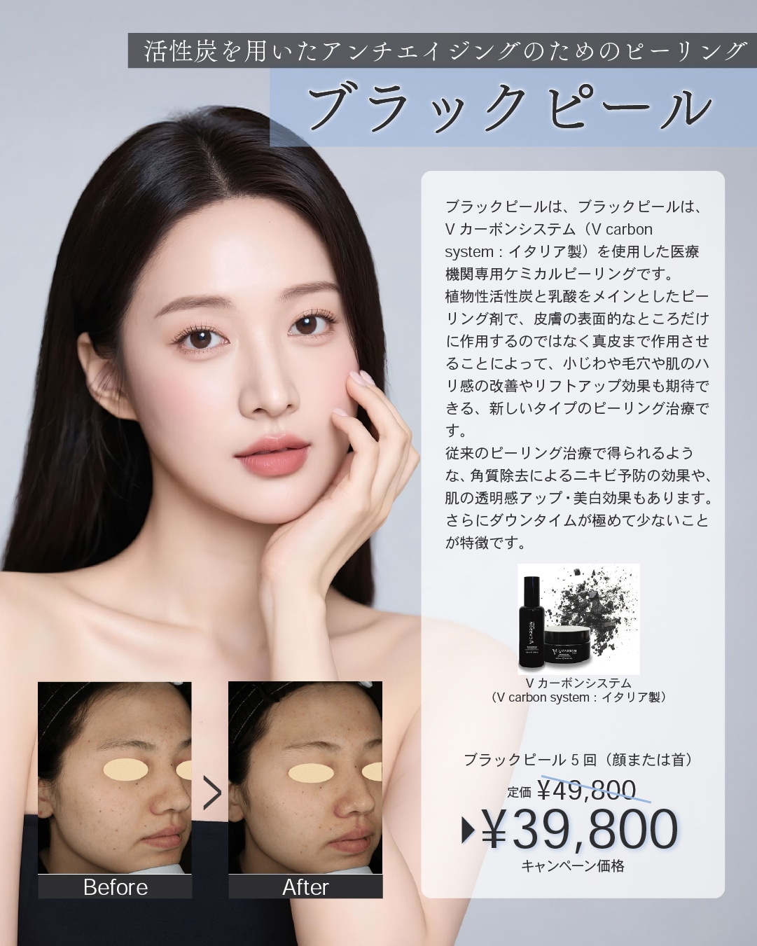 ブラックピール