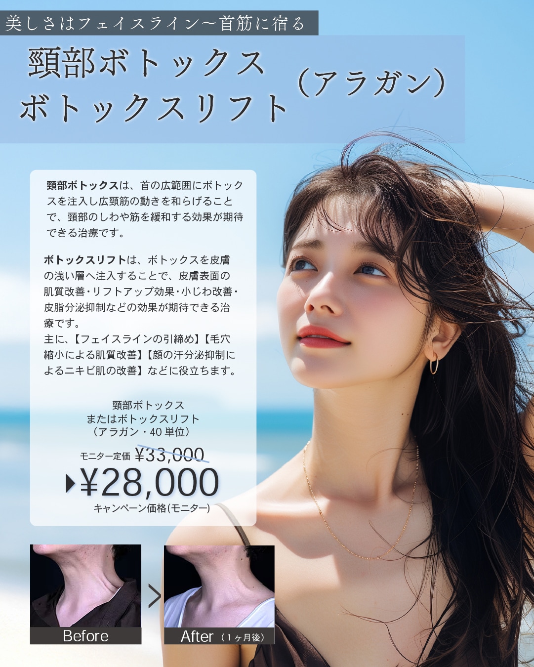 頸部ボトックス/ボトックスリフト