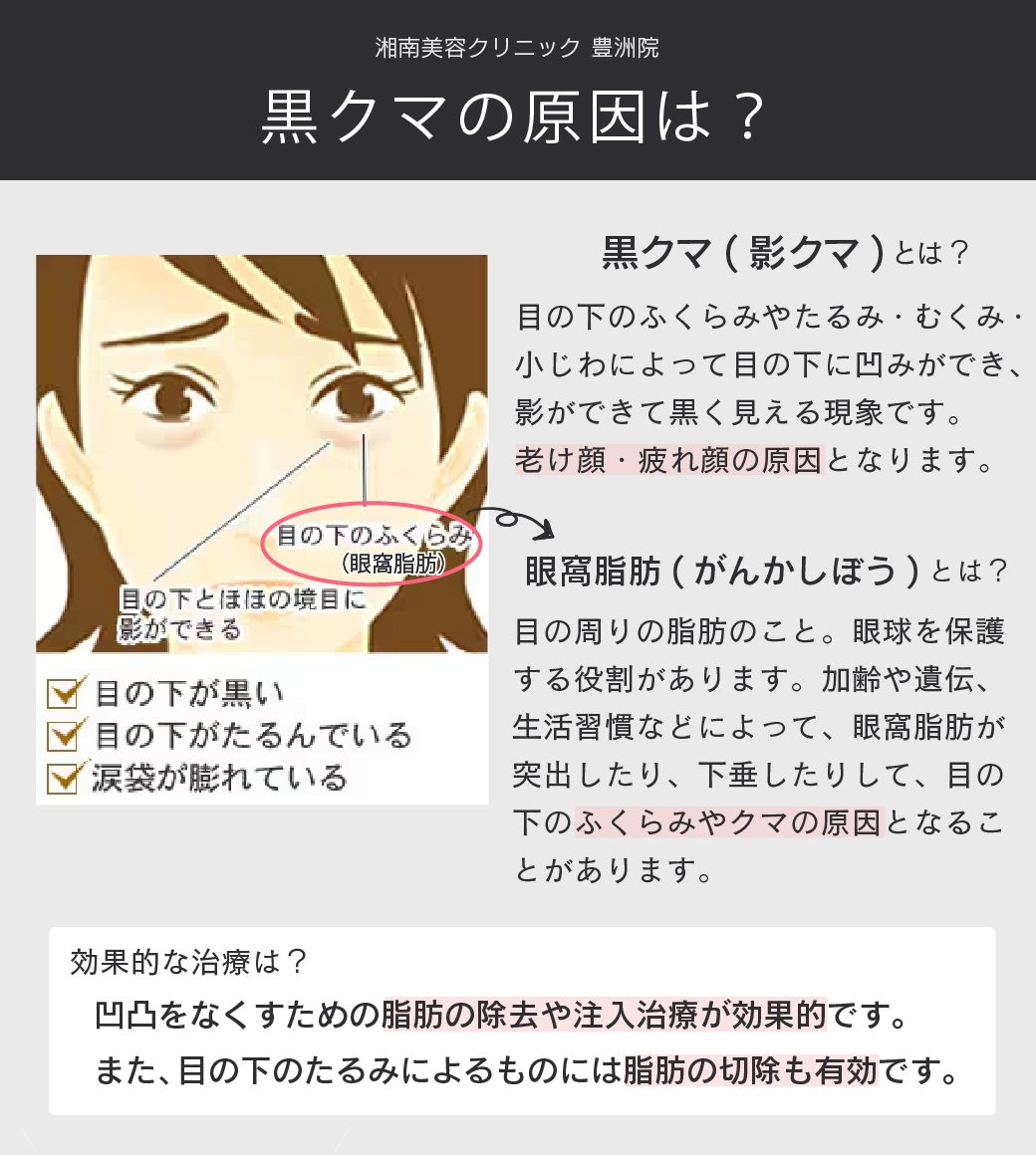 黒クマ（影クマ）の原因　は？