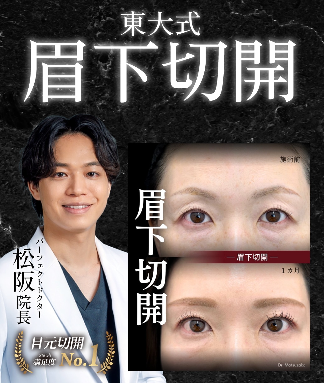 眉下切開(眉下リフト)