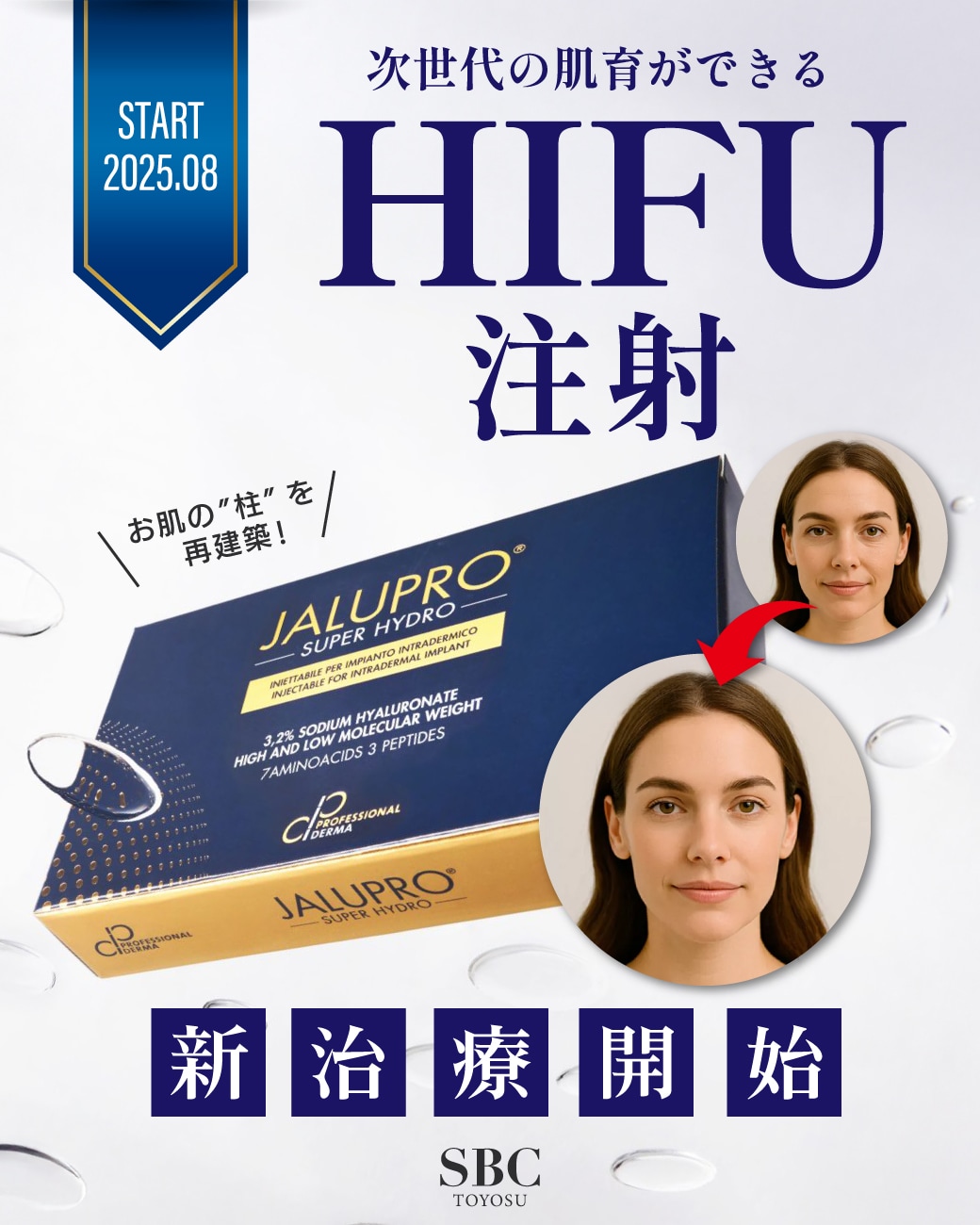 まるでHIFUな肌育注射！「ジャルプロスーパーハイドロ」を新規導入しました！