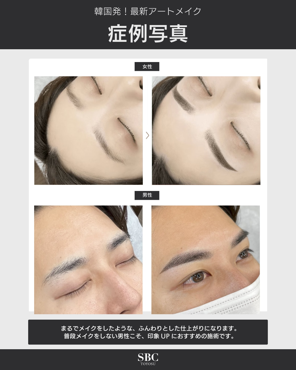 症例写真