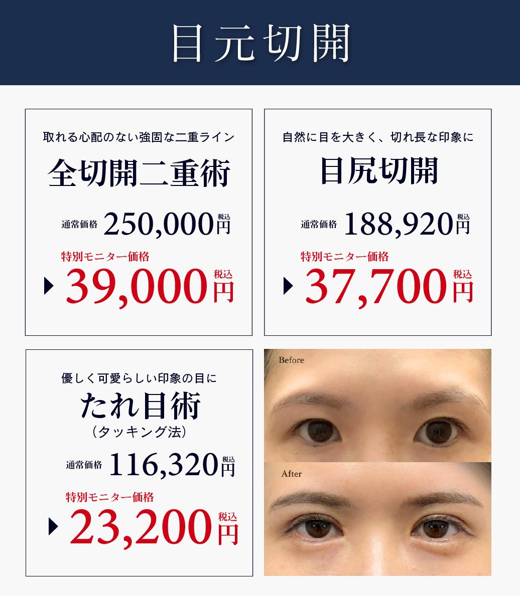 切開のプロがつくる、取れない二重&切れ長アイ