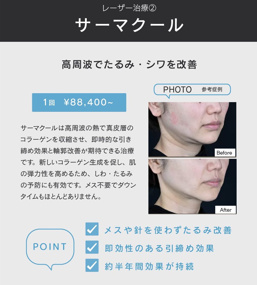 サーマクールとは？