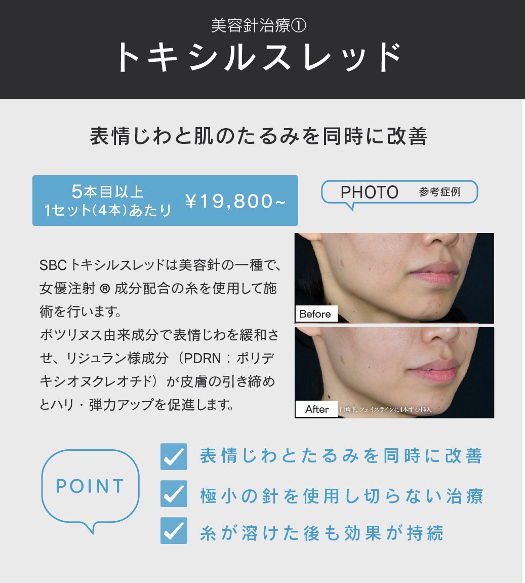 トキシルスレッドとは？