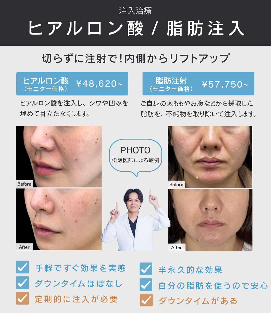 ヒアルロン酸・脂肪注入とは？