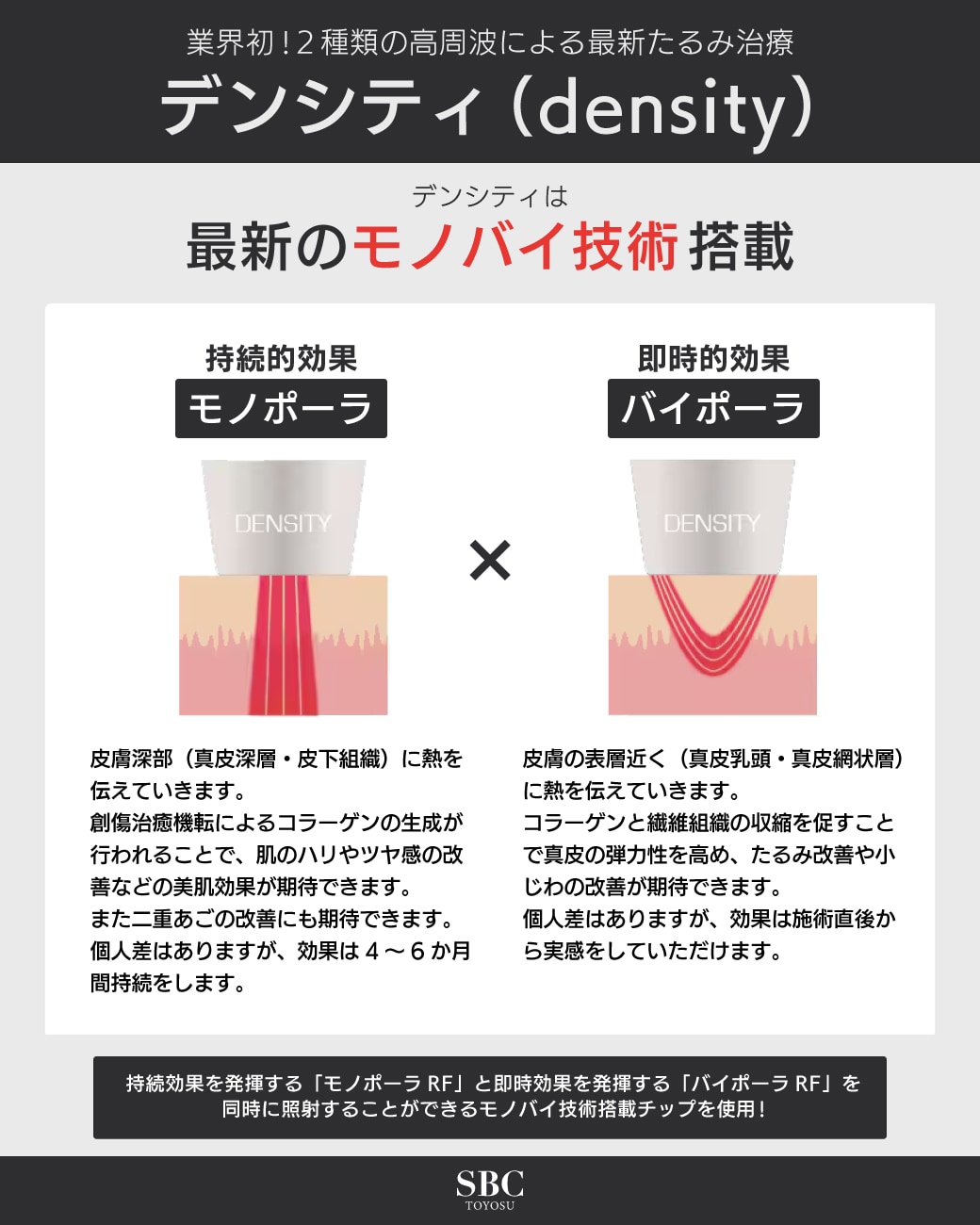 モノポーラとバイポーラを同時に照射可能