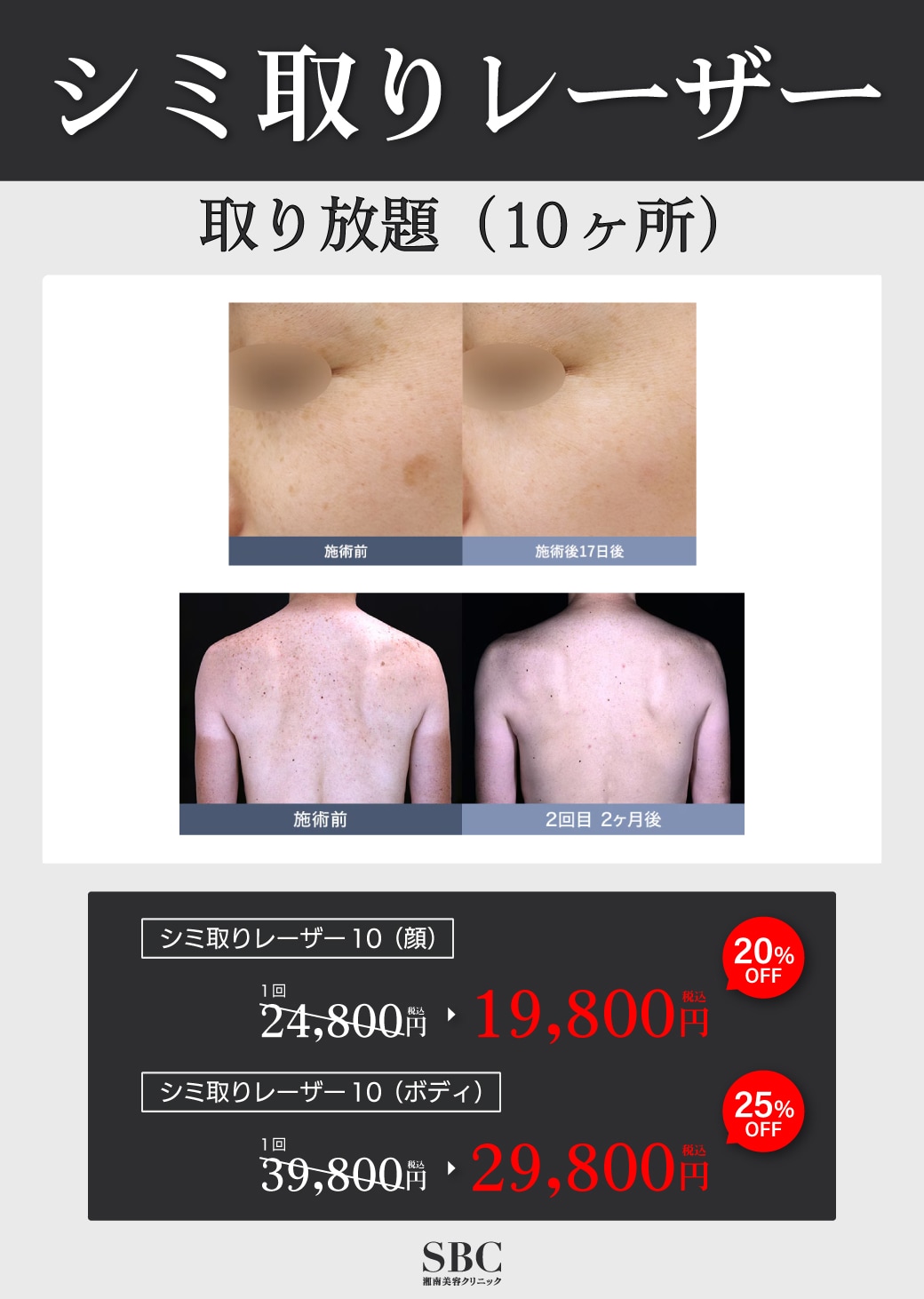 10カ所取り放題