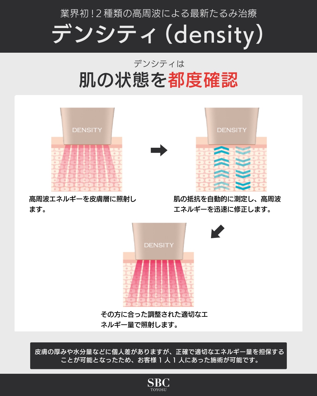一人ひとりのお肌状態に合わせて自動調整