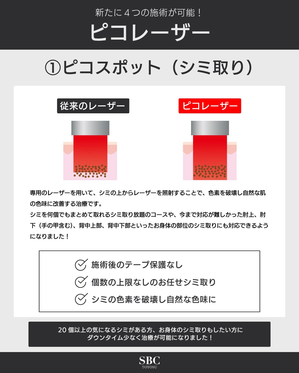 気になる箇所のシミをピンポイントで照射