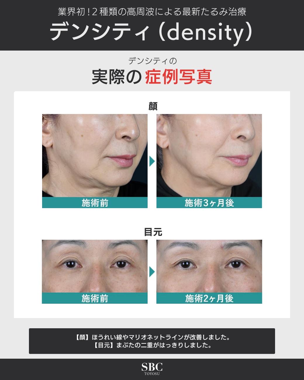 症例写真