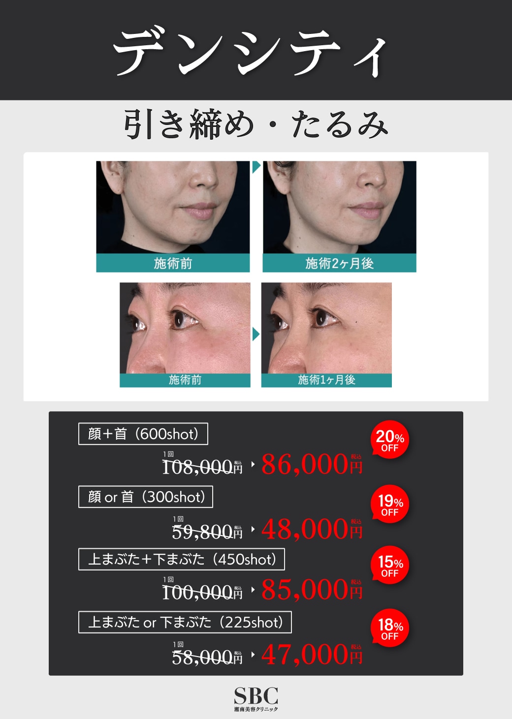 引き締め・たるみ