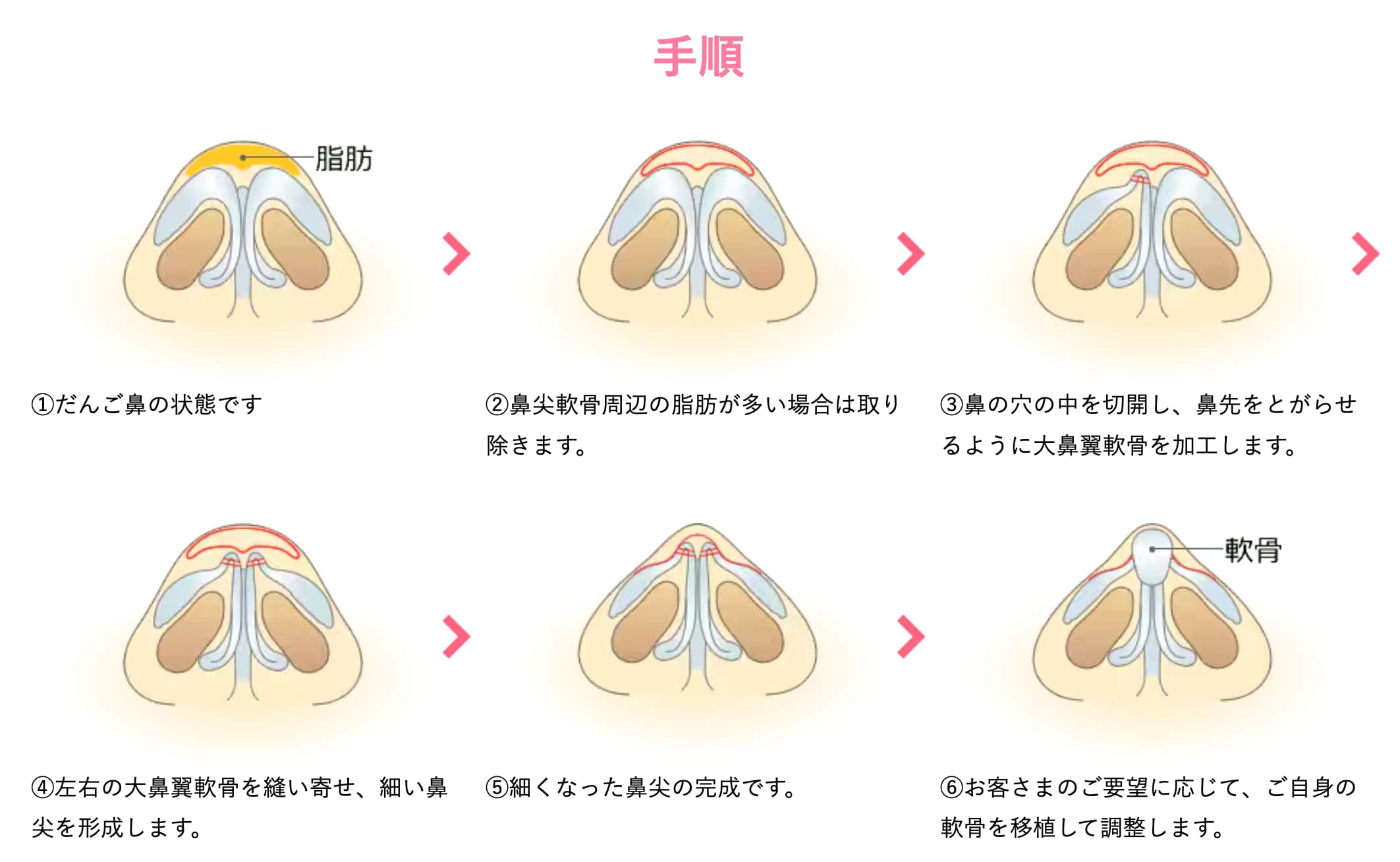 鼻先を整え、全方位美人顔に。