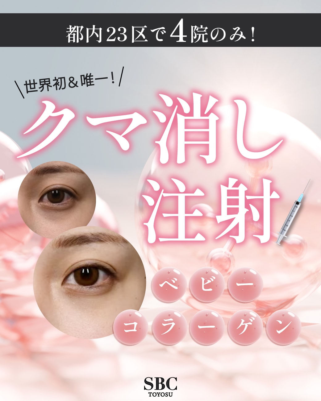 【都内4院のみ】世界初！注射だけで”クマ消し”できる根本治療！ヒューマラジェンこと、「ベビーコラーゲン」の取り扱いを開始！