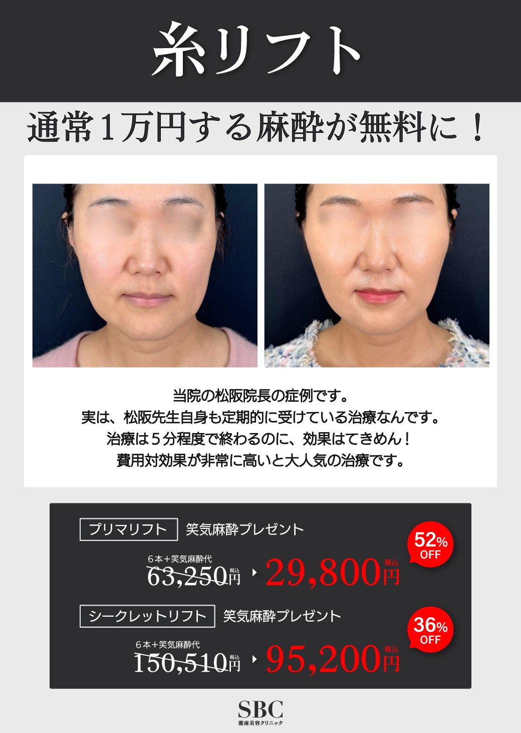 選べる2種の糸リフト