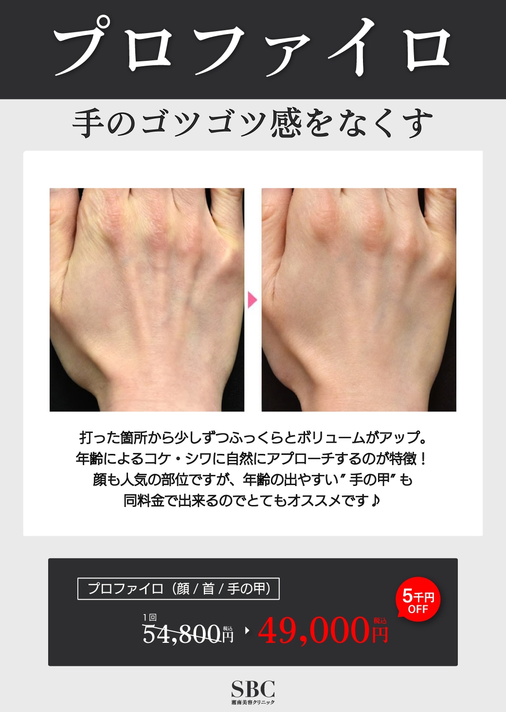 プロファイロ(顔も可能)