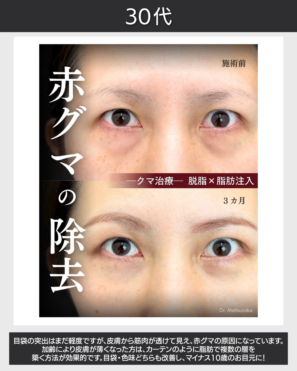 30代 - 老け見えする筋肉や血管の透け感の
