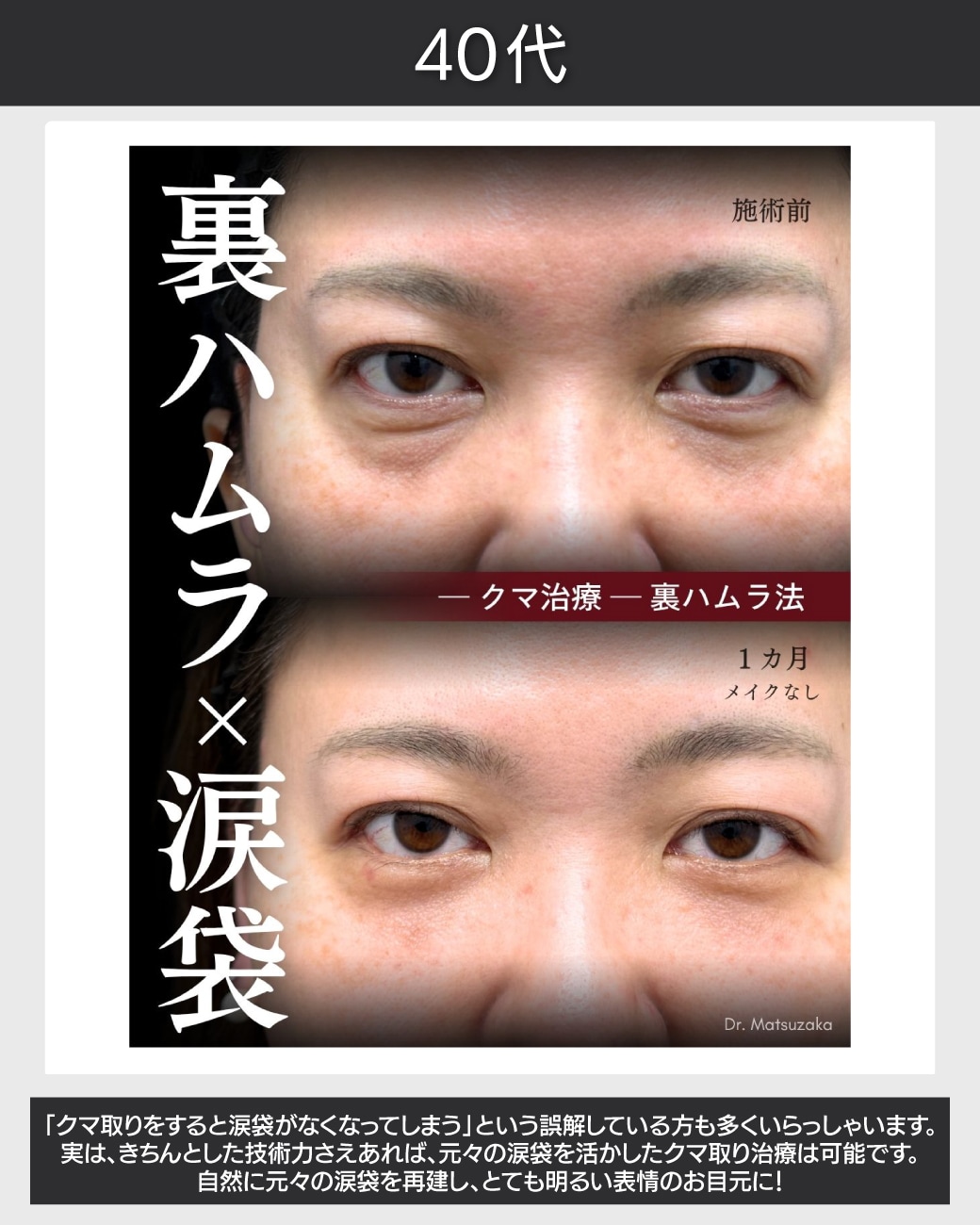 40代 - クマと一体化していた