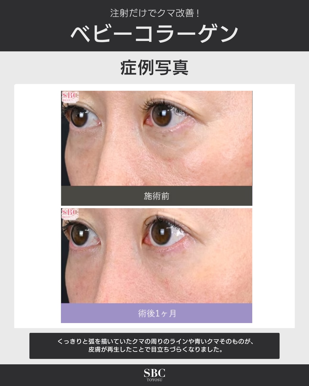 症例写真