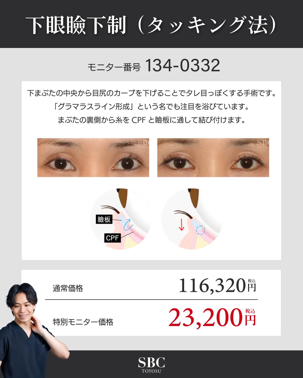 モニター番号:134-0332
