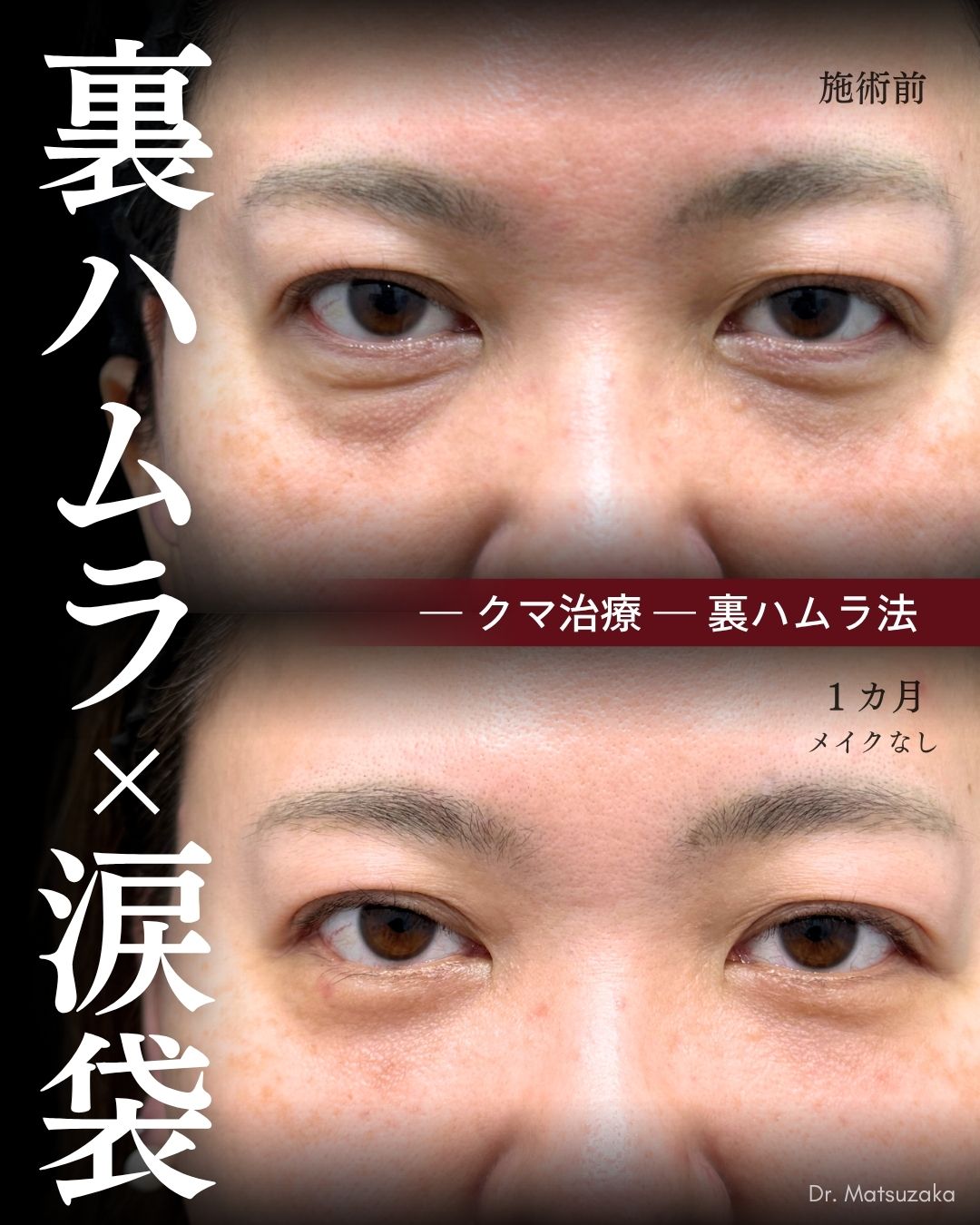 40代 - クマと一体化していた