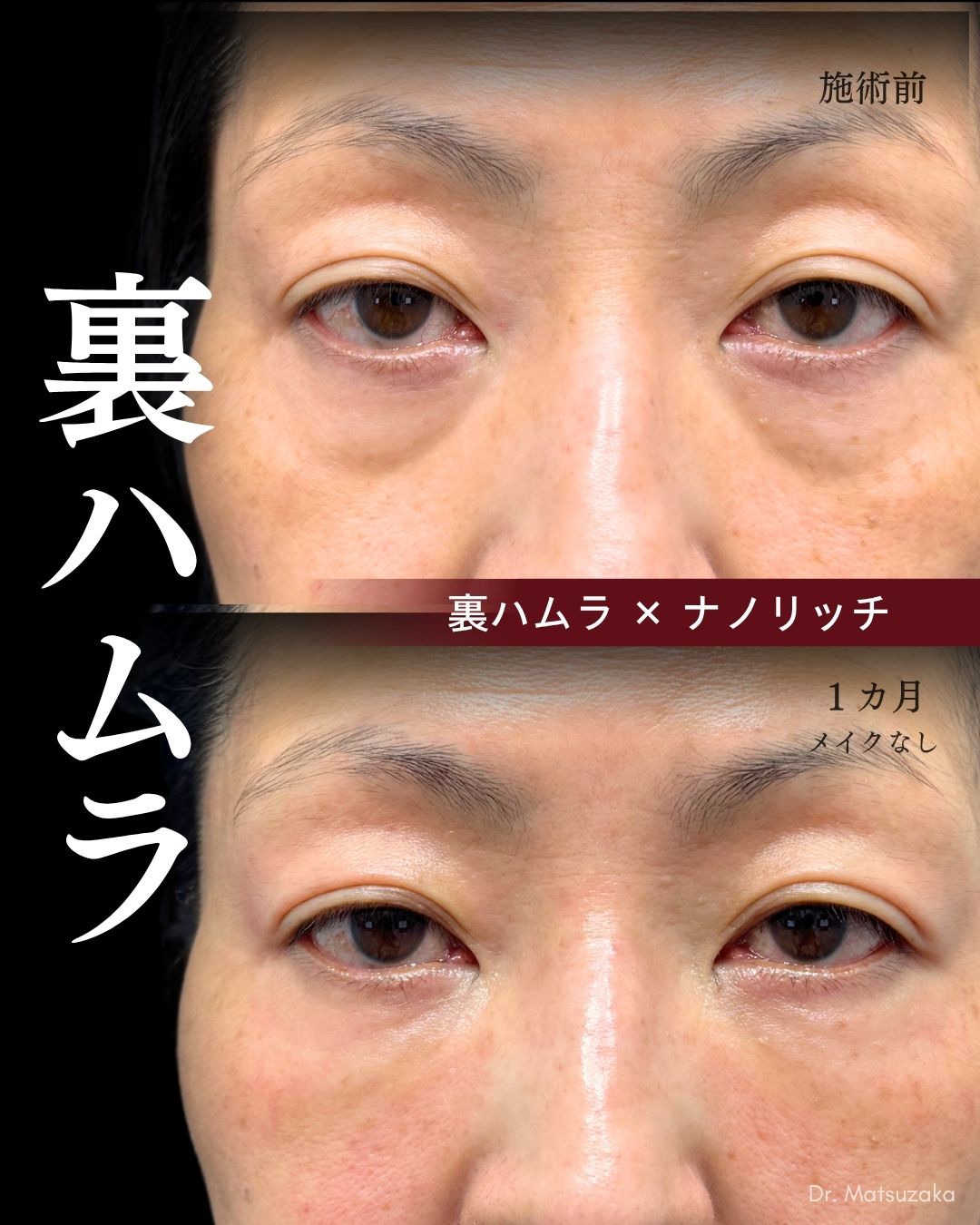 50代 - 長年酷使して緩んでしまった