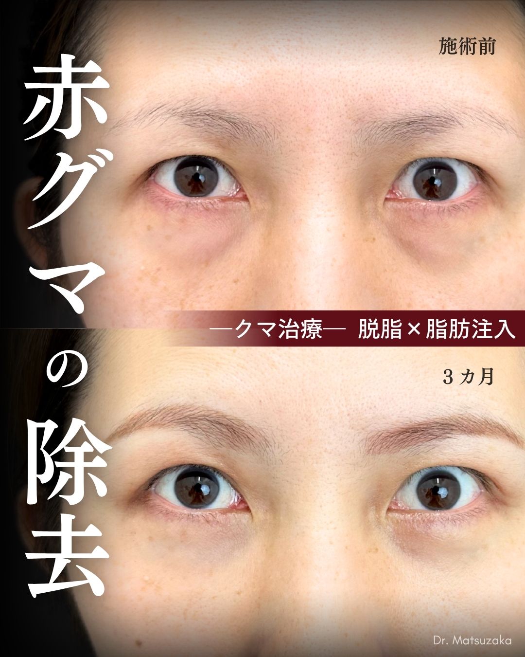30代 - 老け見えする筋肉や血管の透け感の