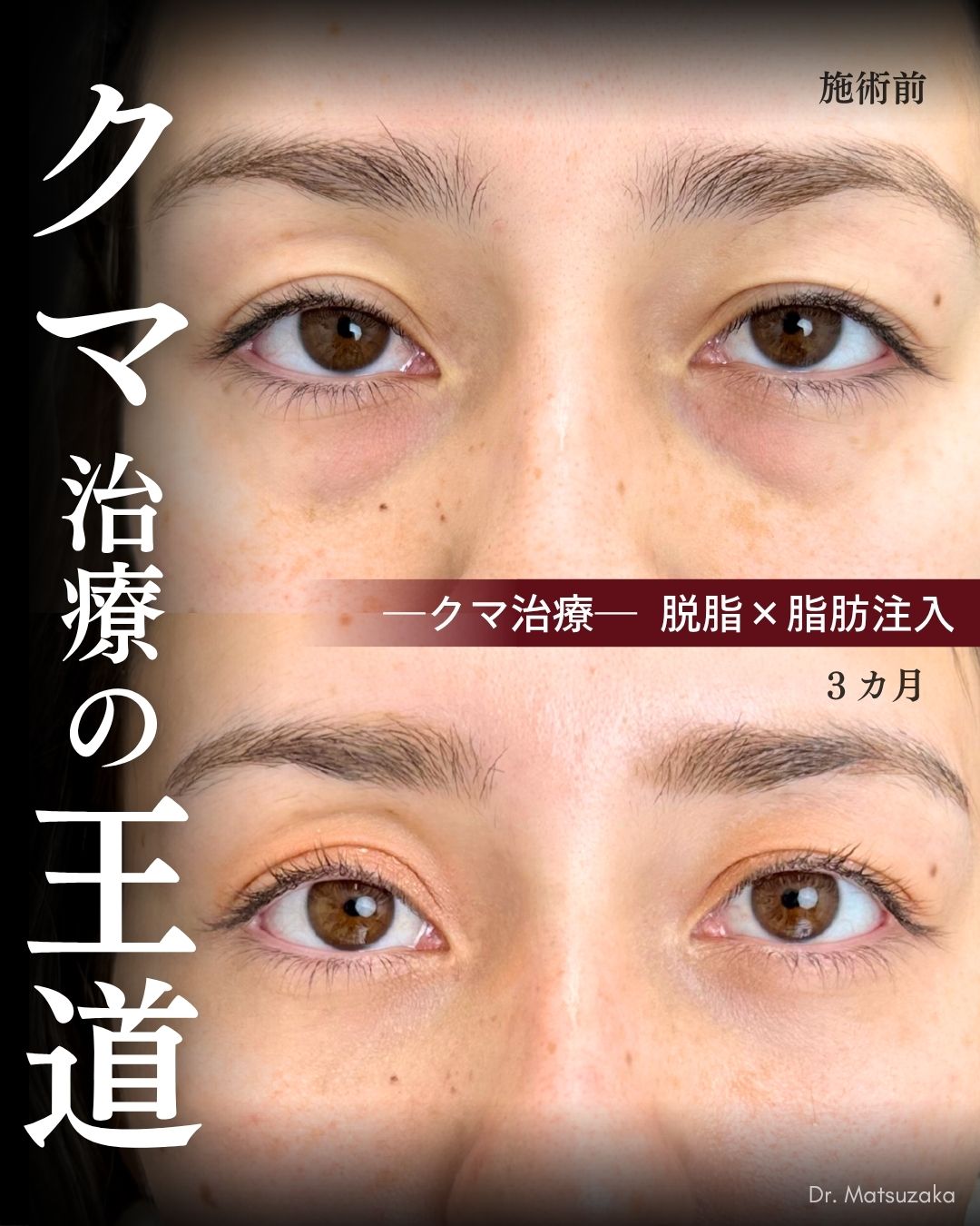 20代 - 光を反射する