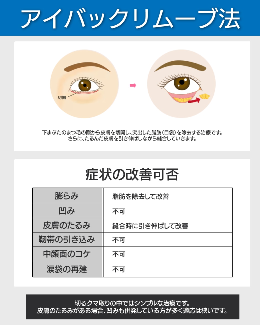 【切るクマ取り】アイバックリムーブ
